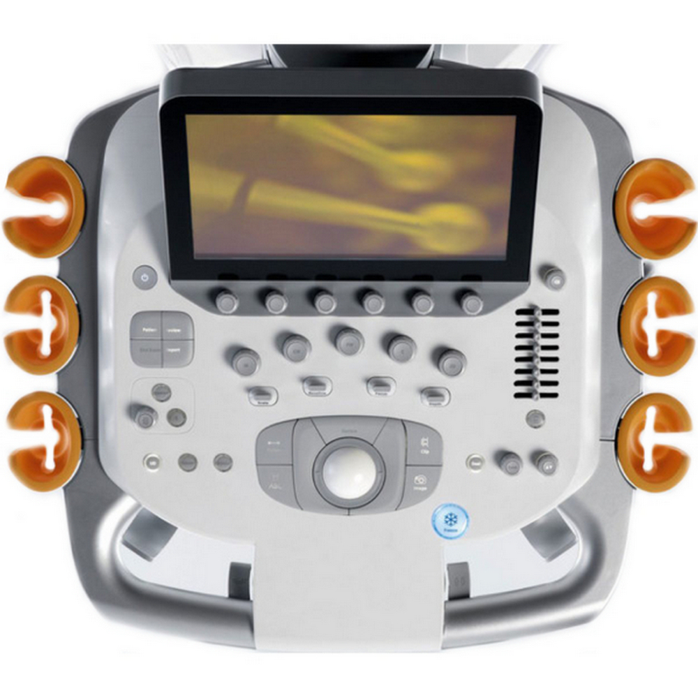 Аппарат УЗИ Siemens ACUSON S3000_69db50949bbc1.jpeg Аппарат УЗИ Siemens ACUSON S3000 — изображение 5