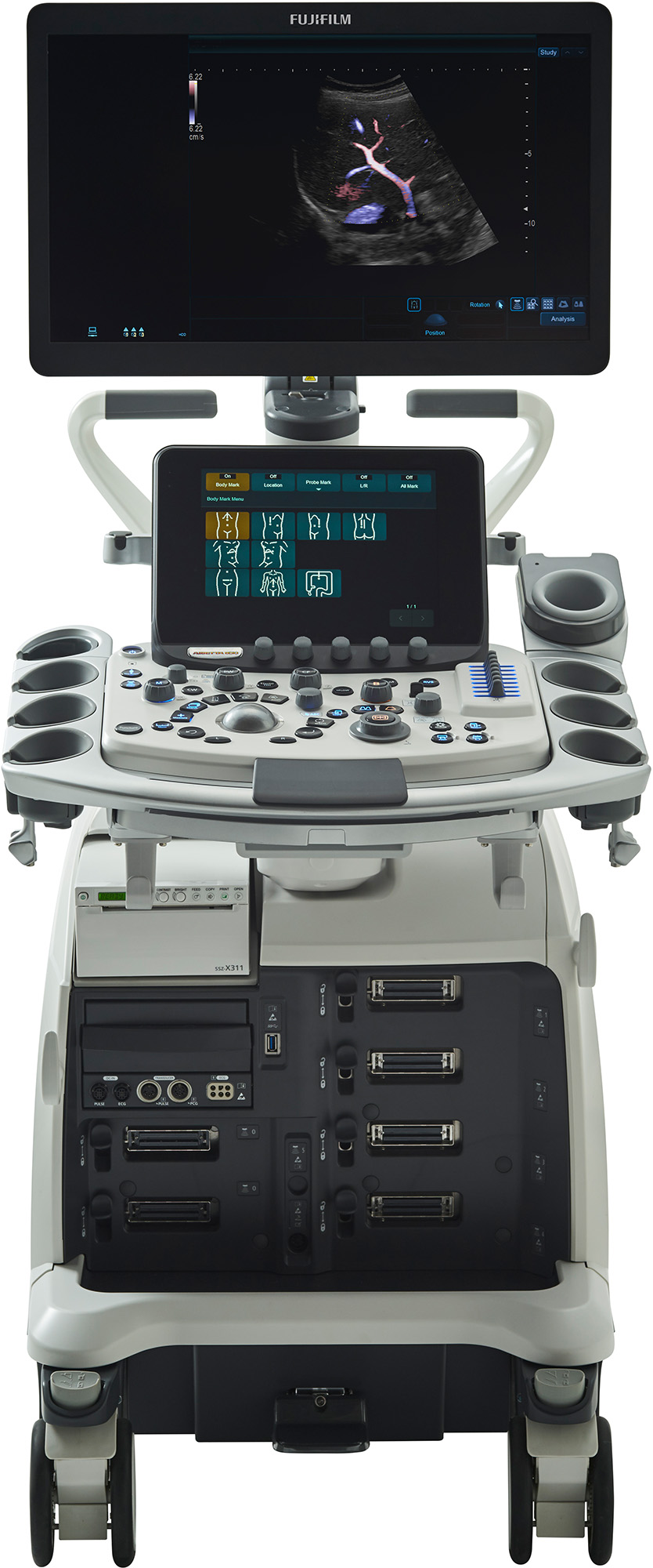 УЗИ аппарат Hitachi Aloka (Fujifilm) Arietta 850_69db4efcee9a6.jpeg УЗИ аппарат Hitachi Aloka (Fujifilm) Arietta 850 — изображение 1