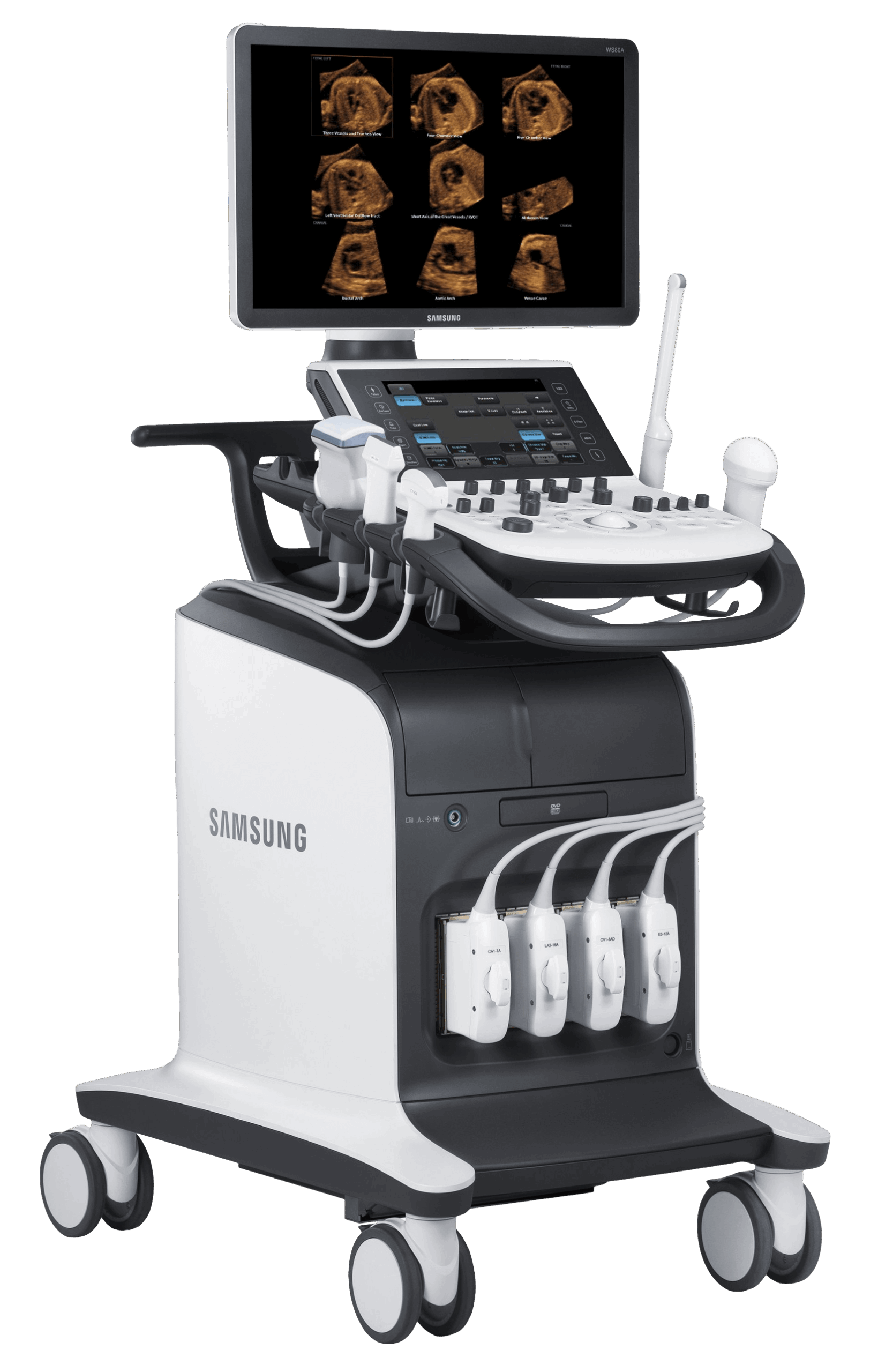 УЗИ аппарат Samsung UGEO WS80A Elite_69d3acd0ec5fb.png УЗИ аппарат Samsung UGEO WS80A Elite — изображение 1