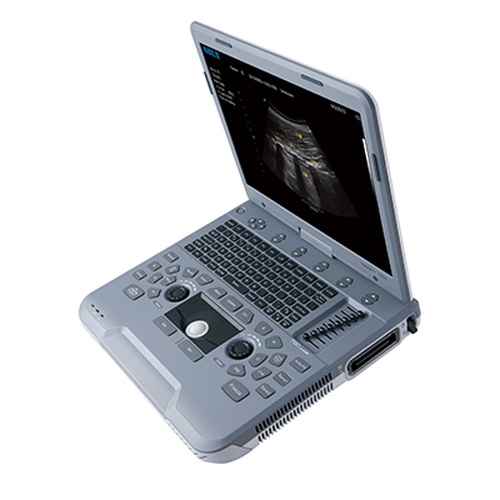 УЗИ аппарат Siui Apogee 1100 Neo_69d3af38bb99b.jpeg УЗИ аппарат Siui Apogee 1100 Neo — изображение 2