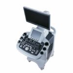 УЗИ аппарат SIUI Apogee 3500 elite — изображение 2