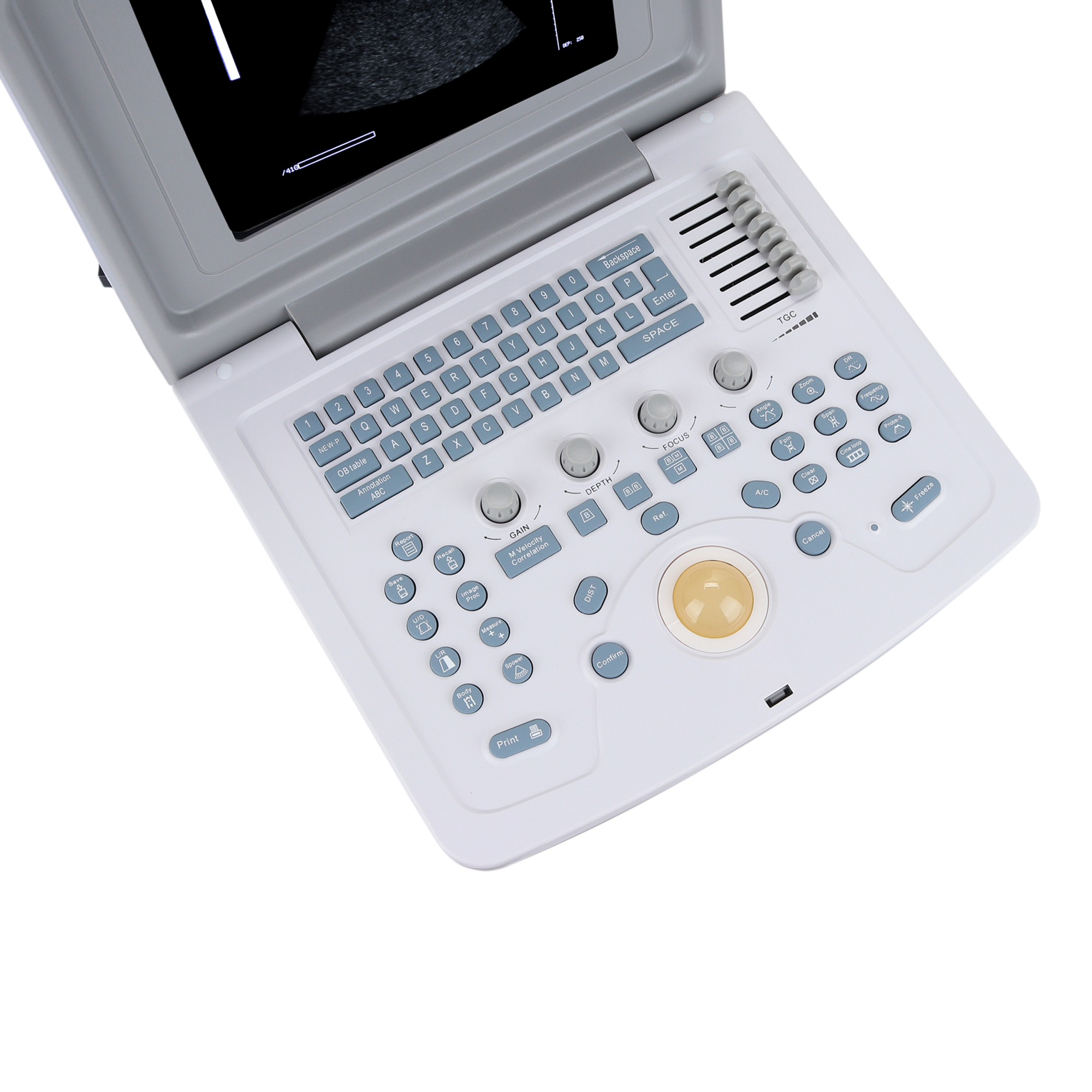 УЗИ сканер Med-Mos CMS600B3_69d3ae1d05c1f.jpeg УЗИ сканер Med-Mos CMS600B3 — изображение 4